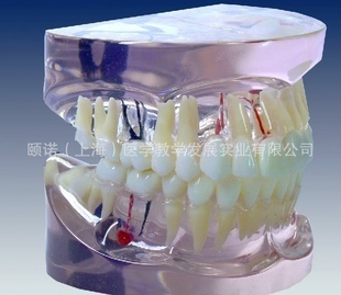 透明牙体病理模型 革新医药教学的利器